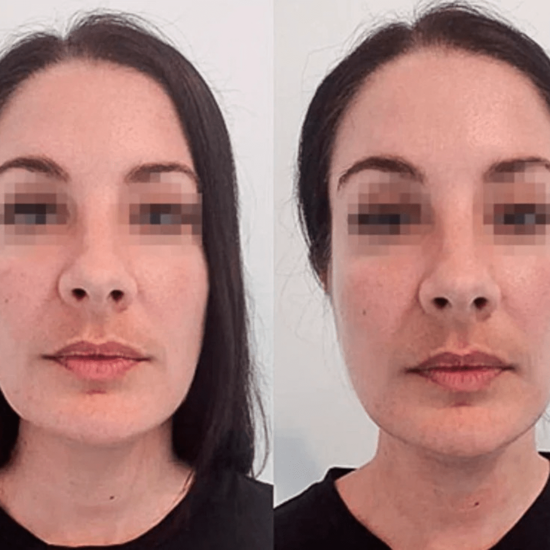 Drainage Lymphatique Naturel – Silhouette affinée, jambes légères, ventre plat - Soxelle