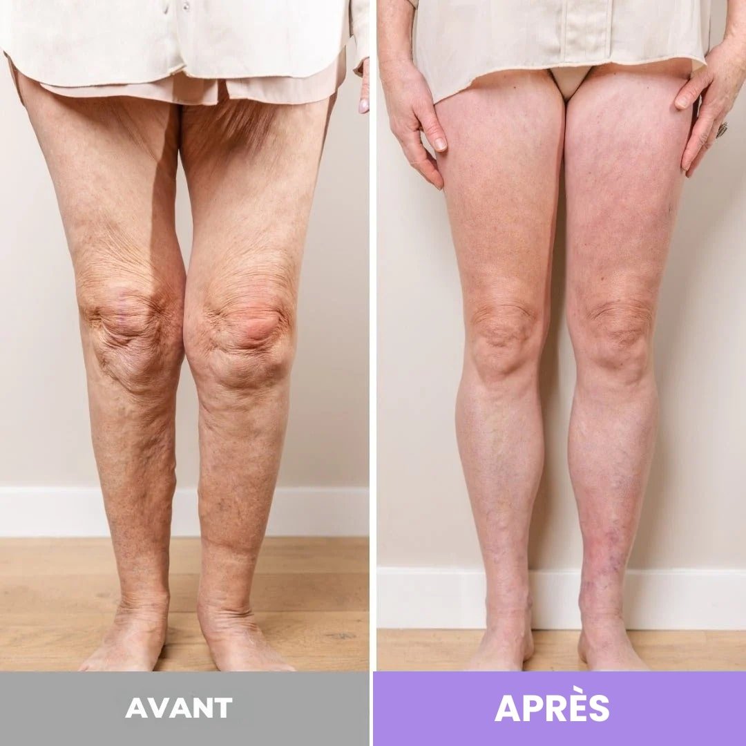 Masseur de pieds - Soxelle - Soxelle