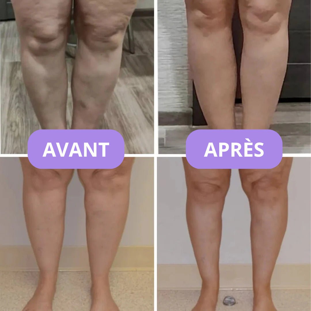 Soxelle - Fini les jambes lourdes et gonflées — la compression élégante qui change vos journées - Soxelle